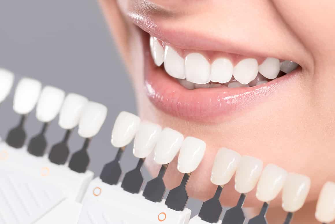 Enhance Your Smile and Overall Appearance with Dental Veneers